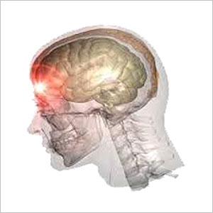 Brain Injury