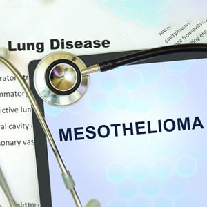 Filing A Mesothelioma Claim In Louisiana